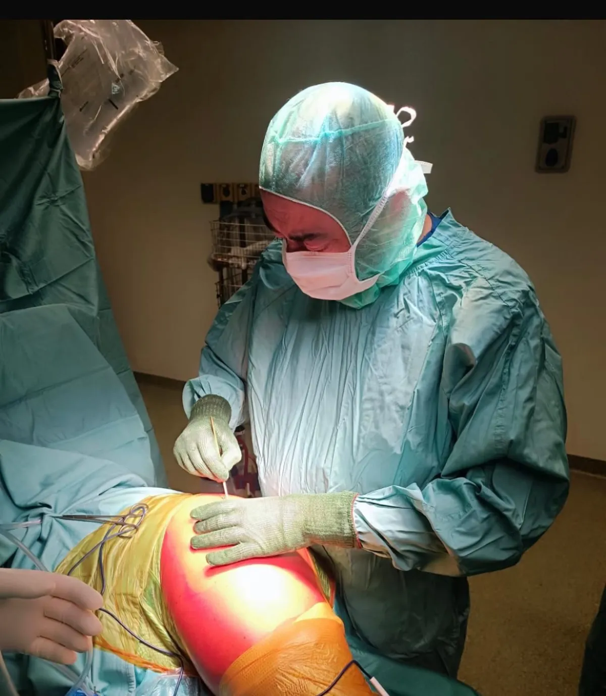 Innovazione medica a Foligno: revisione di protesi d’anca grazie all’innesto di osso equino