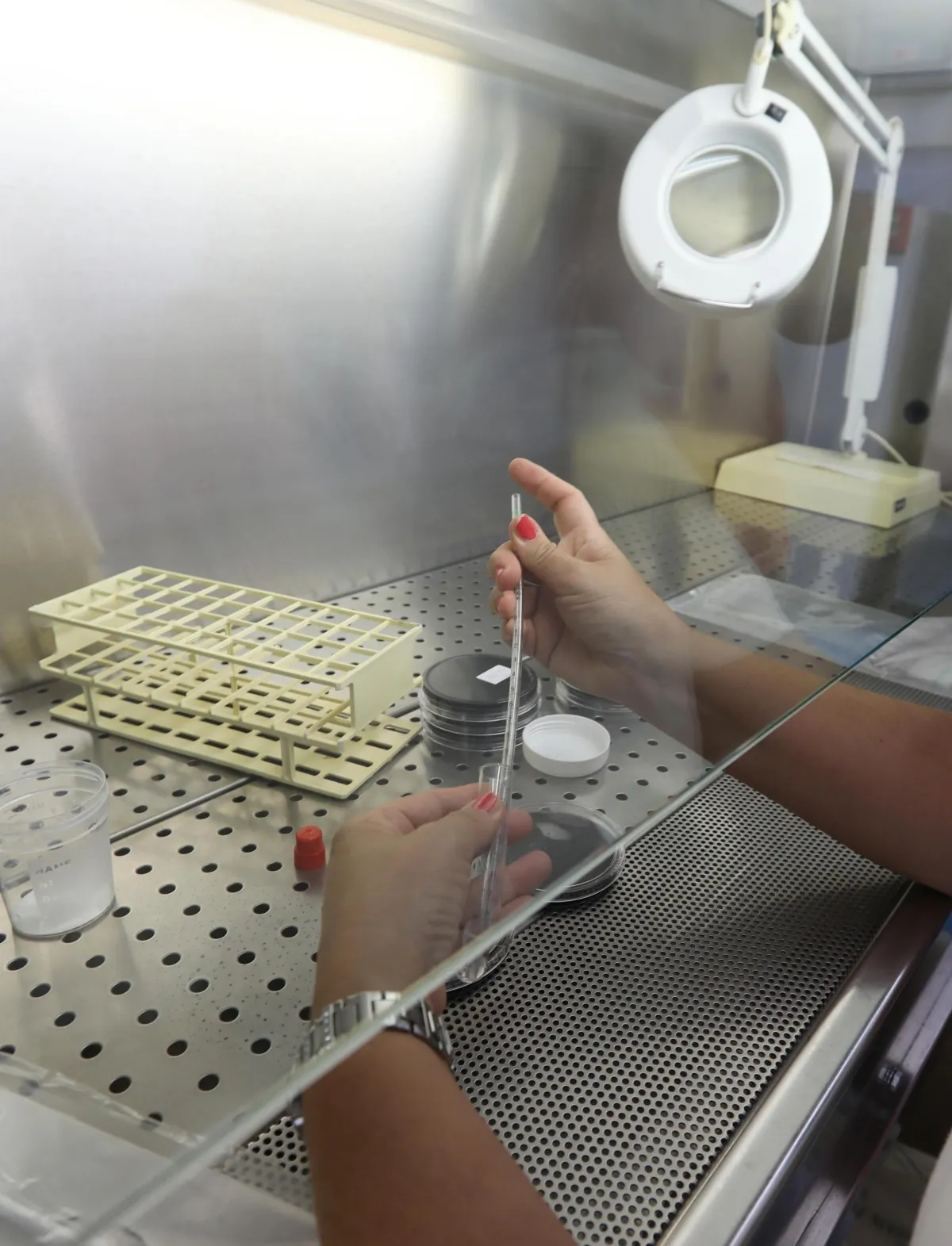 Nuovo caso di legionella nell'acqua. Chiusa in via precauzionale una scuola a Città di Castello