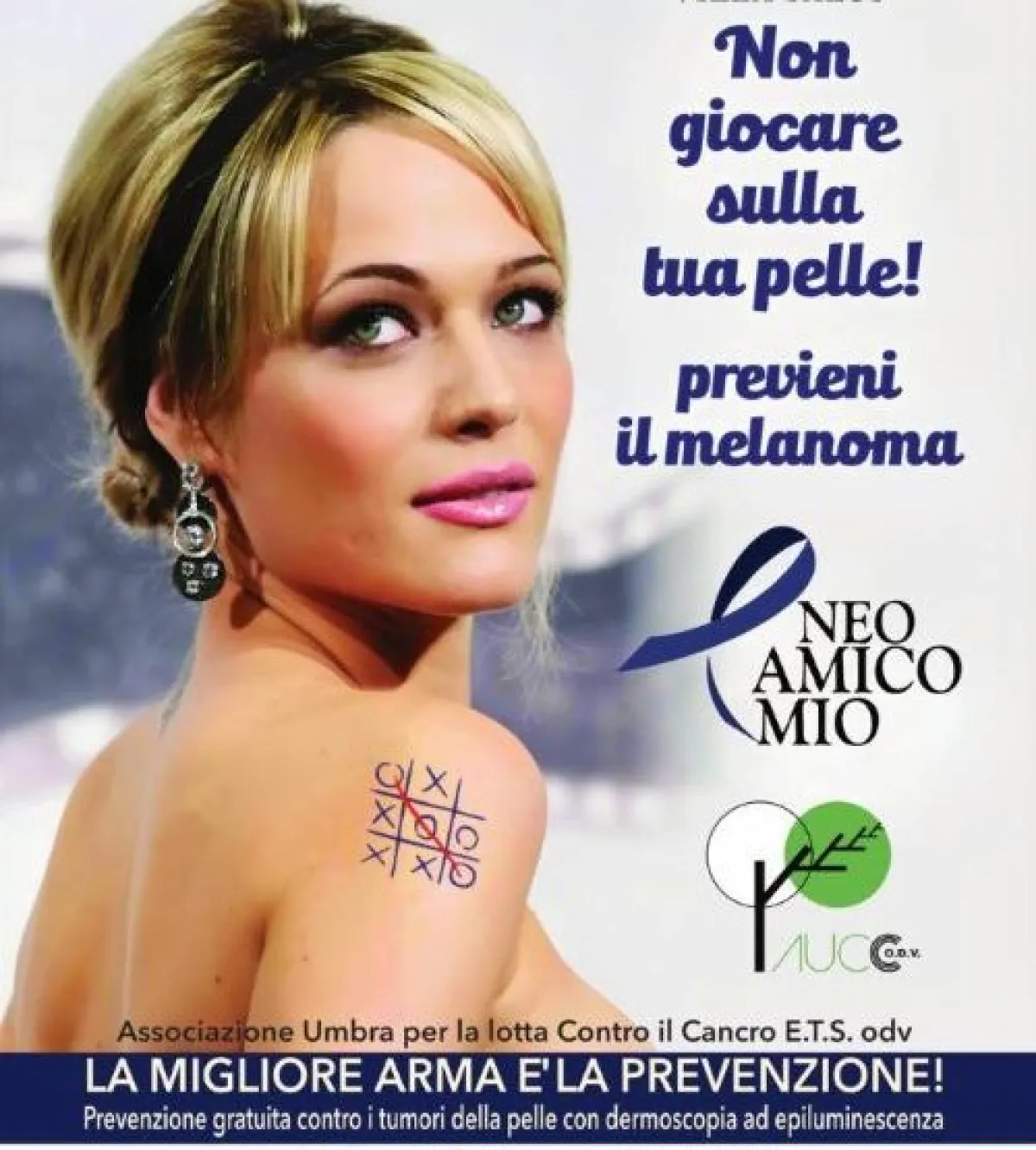 Prevenzione del melanoma, adesioni al completo per "Neo amico mio giornalista": al via il protocollo Aucc-Ordine dei giornalisti in Umbria