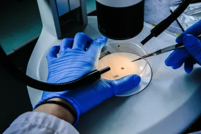 Perugia, segnalato caso di Campylobatteriosi in una scuola: Usl 1 dispone misure preventive 